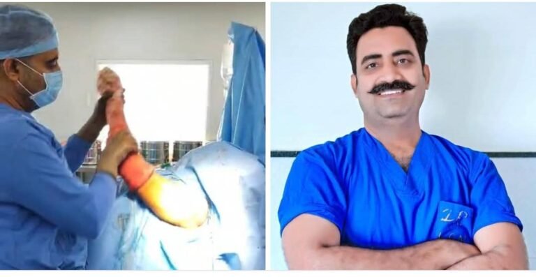 भीलवाड़ा के इतिहास में डॉ. नाथावत ने किया रिवर्स शोल्डर(कंधे ) का रिप्लेसमेंट ऑपरेशन